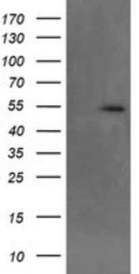 Western Blot: MKRN1 Antibody (OTI2C8) [NBP2-45816]