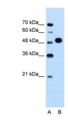 Western Blot: MKRN1 Antibody [NBP1-55226]