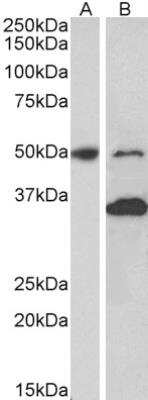 Western Blot: MKRN1 Antibody [NBP2-27545]