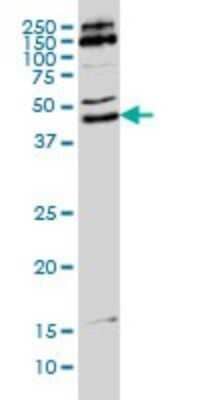 Western Blot: MKRN2 Antibody (5F8) [H00023609-M01]