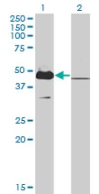 Western Blot: MKRN2 Antibody (5F8) [H00023609-M01]