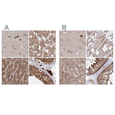 Immunohistochemistry-Paraffin: MKRN2 Antibody [NBP1-83178]