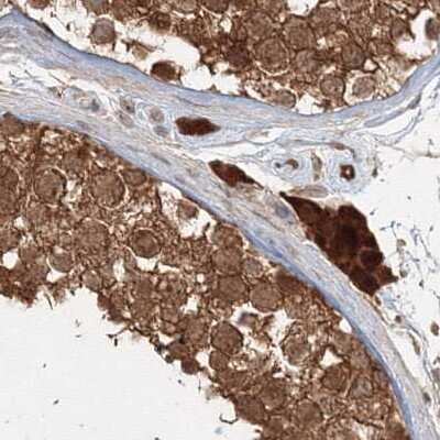 Immunohistochemistry-Paraffin: MKRN2 Antibody [NBP1-83178]