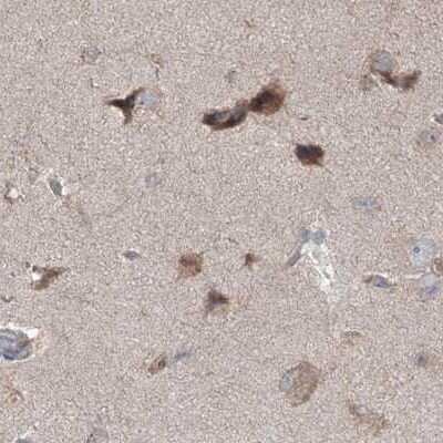 Immunohistochemistry-Paraffin: MKRN2 Antibody [NBP1-83178]