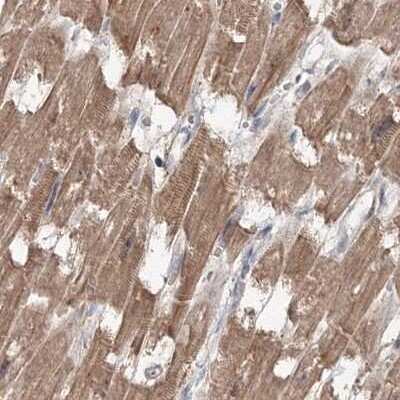 Immunohistochemistry-Paraffin: MKRN2 Antibody [NBP1-83178]