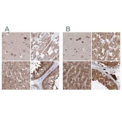 Immunohistochemistry-Paraffin: MKRN2 Antibody [NBP1-83179]