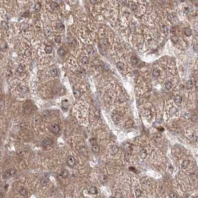 Immunohistochemistry-Paraffin: MKRN2 Antibody [NBP1-83179]