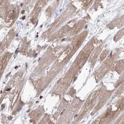 Immunohistochemistry-Paraffin: MKRN2 Antibody [NBP1-83179]