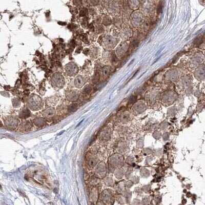 Immunohistochemistry-Paraffin: MKRN2 Antibody [NBP1-83179]