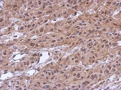 Immunohistochemistry-Paraffin: MKRN2 Antibody [NBP2-17301]
