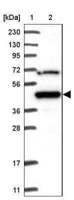 Western Blot: MKRN2 Antibody [NBP1-83178]