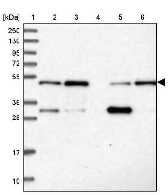 Western Blot: MKRN2 Antibody [NBP1-83179]