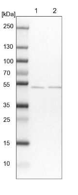 Western Blot: MKRN2 Antibody [NBP1-83179]