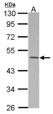 Western Blot: MKRN2 Antibody [NBP2-17302]