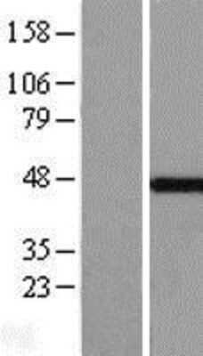 Western Blot: MKRN2 Overexpression Lysate [NBL1-13127]