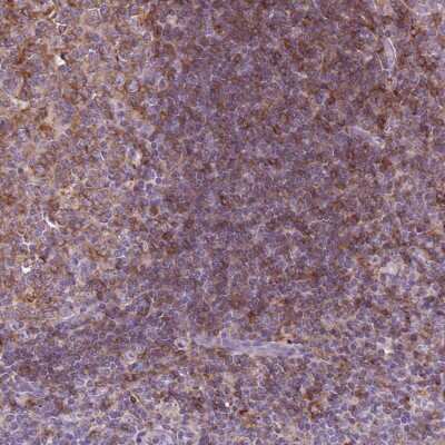 Immunohistochemistry: MKRN2OS Antibody [NBP2-49452]