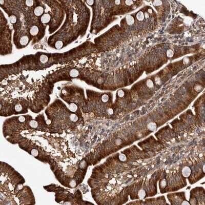 Immunohistochemistry-Paraffin: MKRN3 Antibody [NBP1-84320]