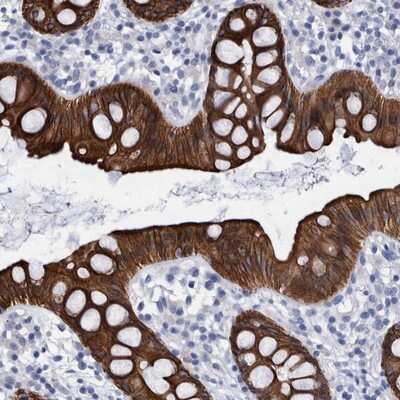 Immunohistochemistry-Paraffin: MKS1 Antibody [NBP1-88691]