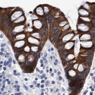 Immunohistochemistry-Paraffin: MKS1 Antibody [NBP1-88691]