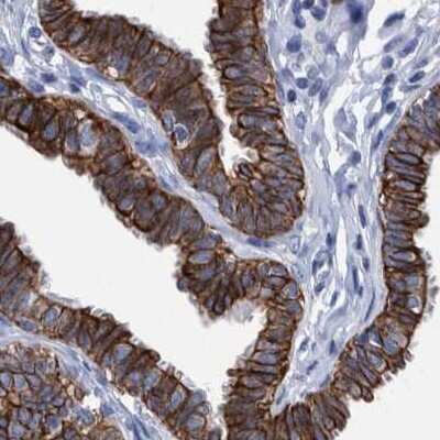 Immunohistochemistry-Paraffin: MKS1 Antibody [NBP1-88691]