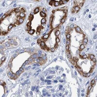 Immunohistochemistry-Paraffin: MKS1 Antibody [NBP1-88691]