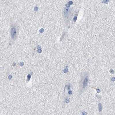 Immunohistochemistry-Paraffin: MKS1 Antibody [NBP1-88691]