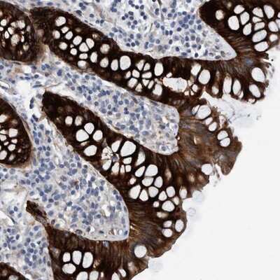 Immunohistochemistry-Paraffin: MKS1 Antibody [NBP1-88692]