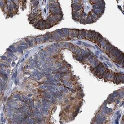 Immunohistochemistry-Paraffin: MKS1 Antibody [NBP1-88692]