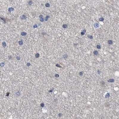 Immunohistochemistry-Paraffin: MKS1 Antibody [NBP1-88692]