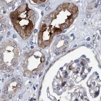 Immunohistochemistry-Paraffin: MKS1 Antibody [NBP1-88692]