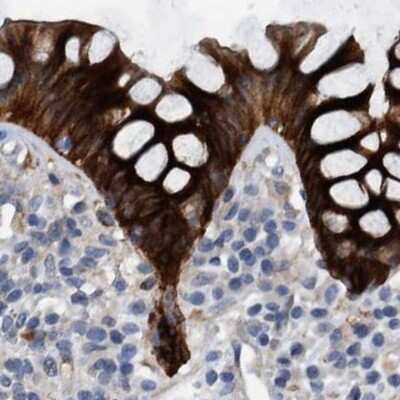 Immunohistochemistry-Paraffin: MKS1 Antibody [NBP1-88692]