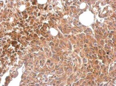 Immunohistochemistry-Paraffin: MKS1 Antibody [NBP2-17303]