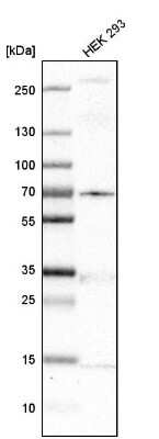 Western Blot: MKS1 Antibody [NBP1-88691]