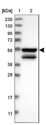 Western Blot: MKS1 Antibody [NBP1-88692]