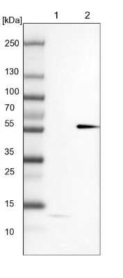 Western Blot: MKS1 Antibody [NBP1-88692]