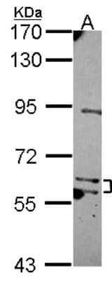 Western Blot: MKS1 Antibody [NBP2-17303]