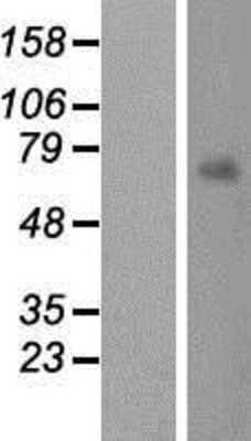 Western Blot: MKS1 Overexpression Lysate [NBP2-06923]