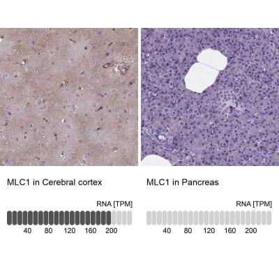 Immunohistochemistry-Paraffin: MLC1 Antibody [NBP1-81555]