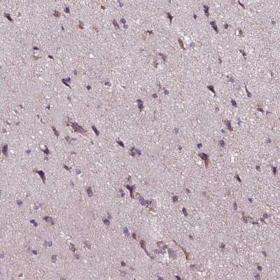 Immunohistochemistry-Paraffin: MLC1 Antibody [NBP2-39086]