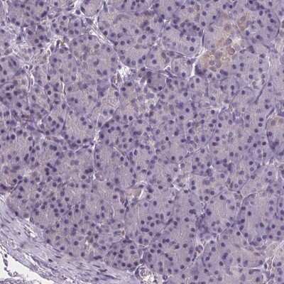 Immunohistochemistry-Paraffin: MLC1 Antibody [NBP2-39086]
