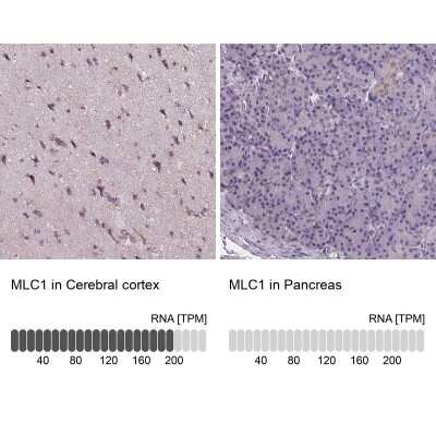 Immunohistochemistry-Paraffin: MLC1 Antibody [NBP2-39086]