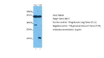 Western Blot: MLC1 Antibody [NBP1-80073]