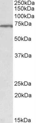 Western Blot: MLC1 Antibody [NBP2-26196]