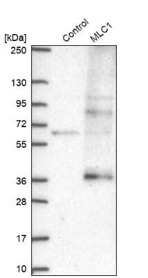 Western Blot: MLC1 Antibody [NBP2-39086]