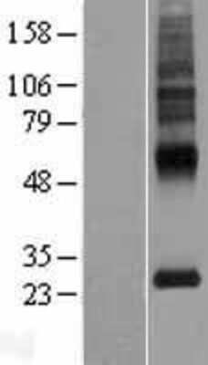 Western Blot: MLC1 Overexpression Lysate [NBP2-05581]