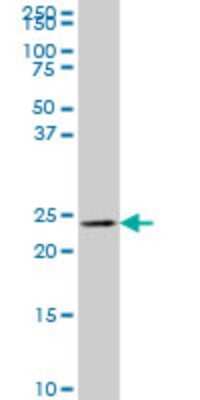 Western Blot: MLC1SA Antibody (4G11) [H00140465-M01]