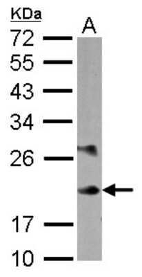 Western Blot: MLC1SA Antibody [NBP2-17304]