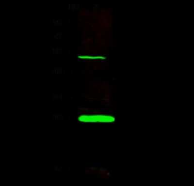 Western Blot: MLC1SA Antibody [NBP2-99163]