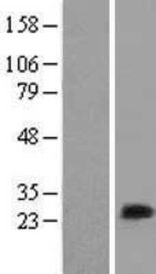 Western Blot: MLC1SA Overexpression Lysate [NBL1-13428]