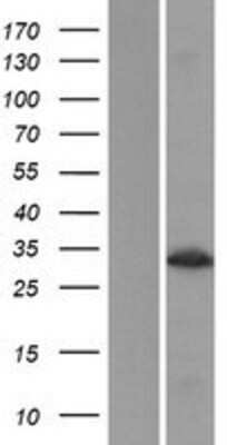 Western Blot: MLEC Overexpression Lysate [NBP2-07292]